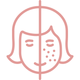 Fades Dark Spots and sun damage.