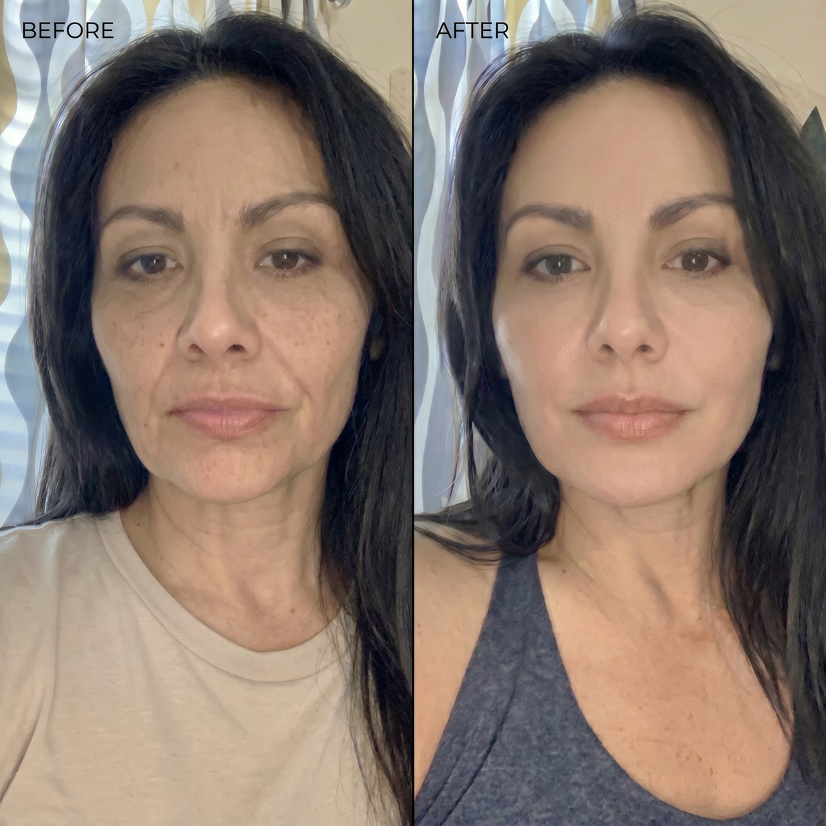 Advanced Peptide Renewal Serum