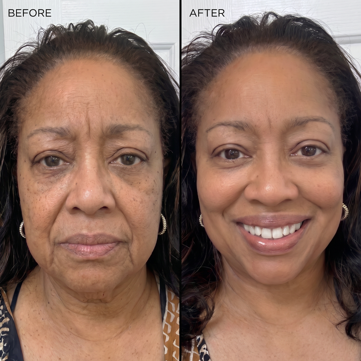 Advanced Peptide Renewal Serum