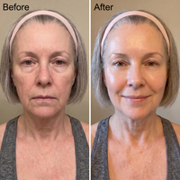 Advanced Peptide Renewal Serum